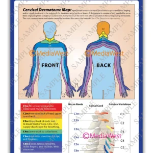 Cervical Dermatome Map Poster