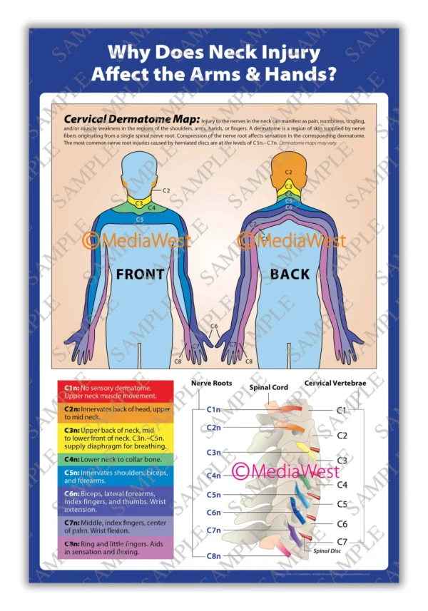image-posters-ZOOM-v1-cervical Cervical Dermatome Map Poster
