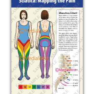 Sciatica Poster