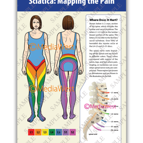 Sciatica Poster