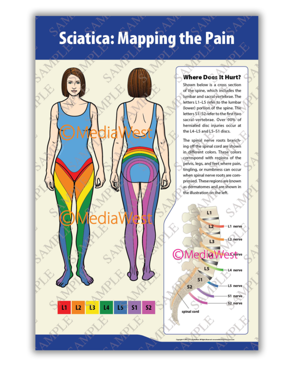image-posters-v3-sciatica Sciatica Poster